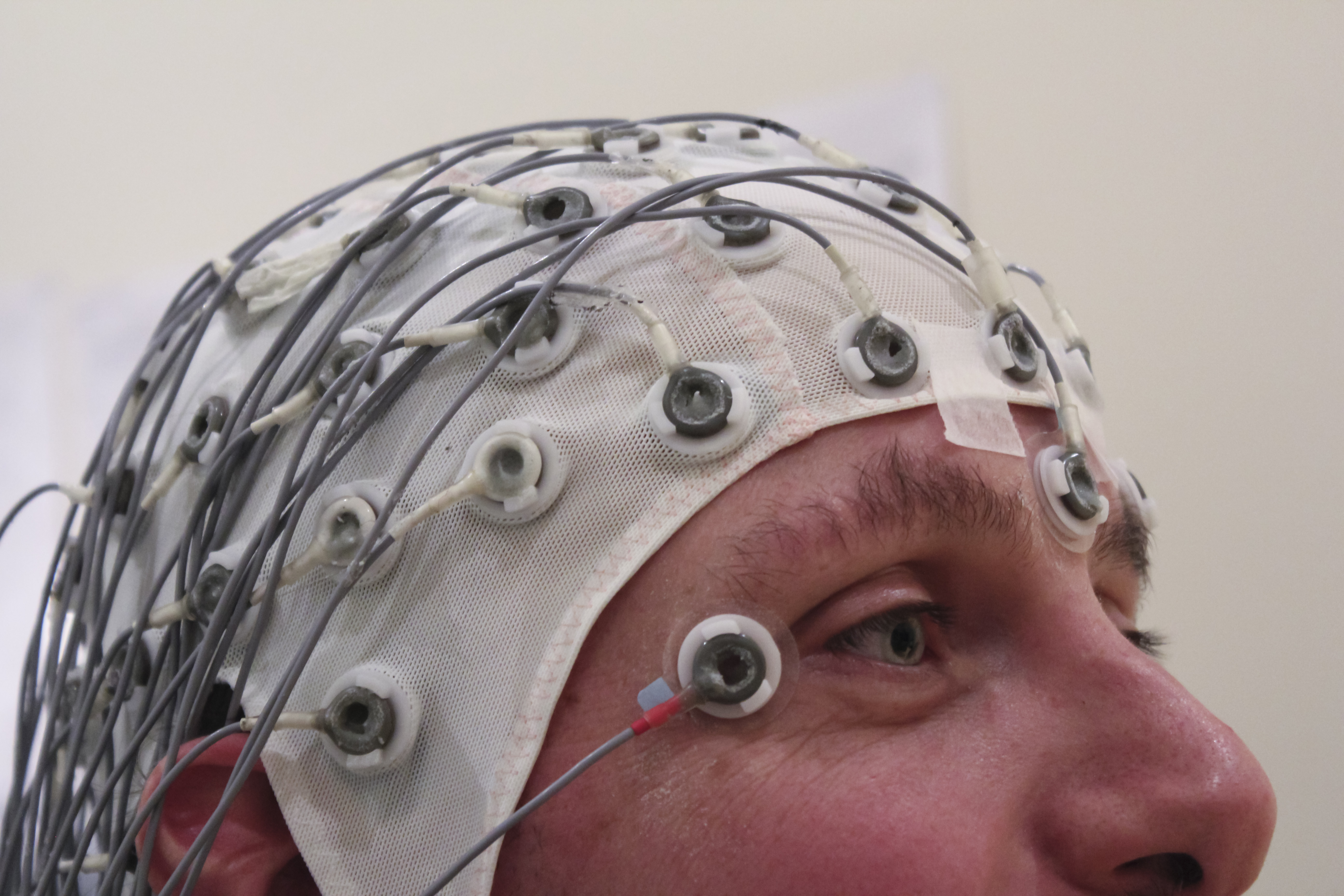 Claude Code Autonomously Optimized a Brain-Computer Interface for an ALS Patient