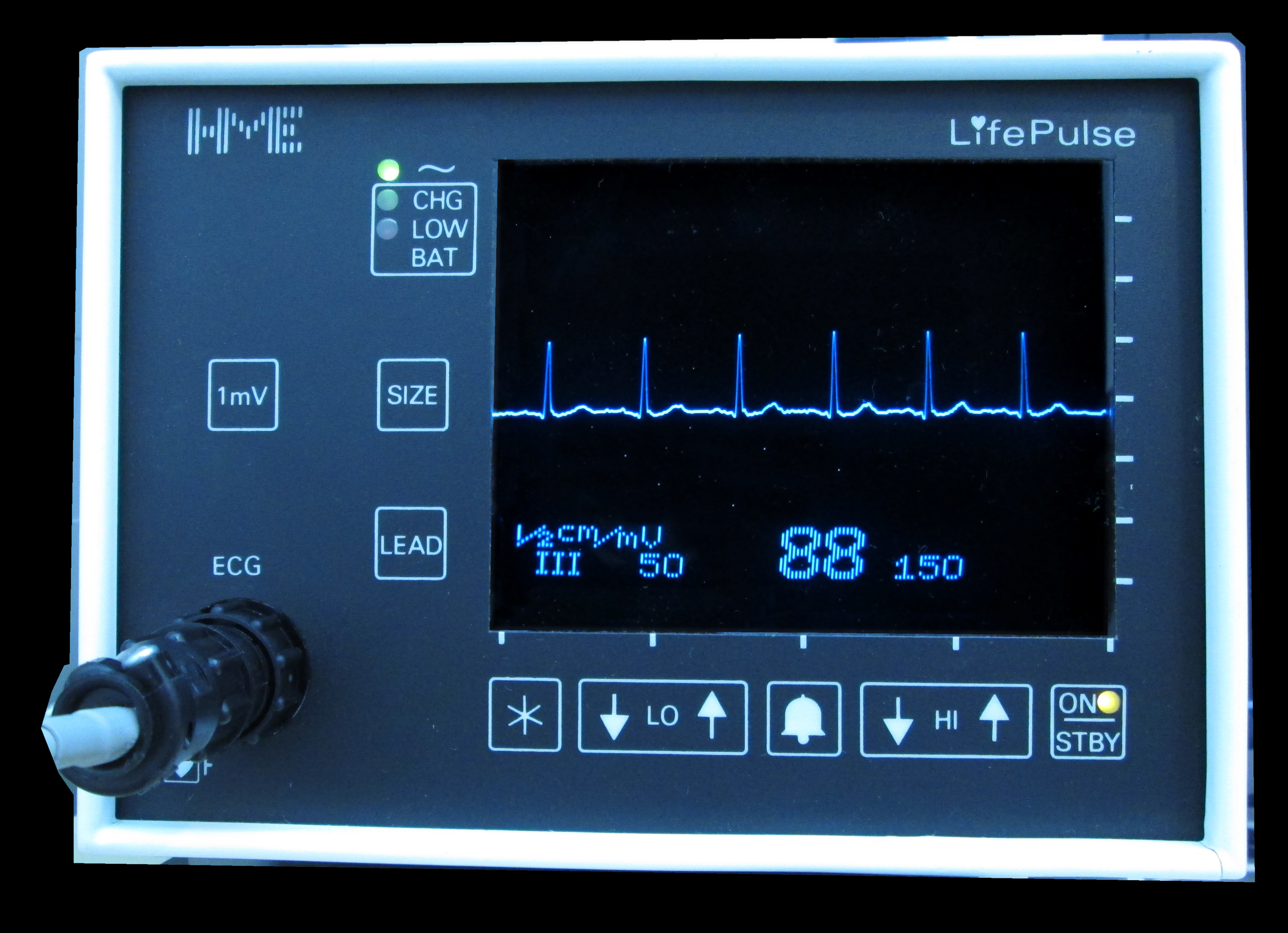 ECG-CLIP AI Model Detects Heart Disease From a Dozen ECG Examples