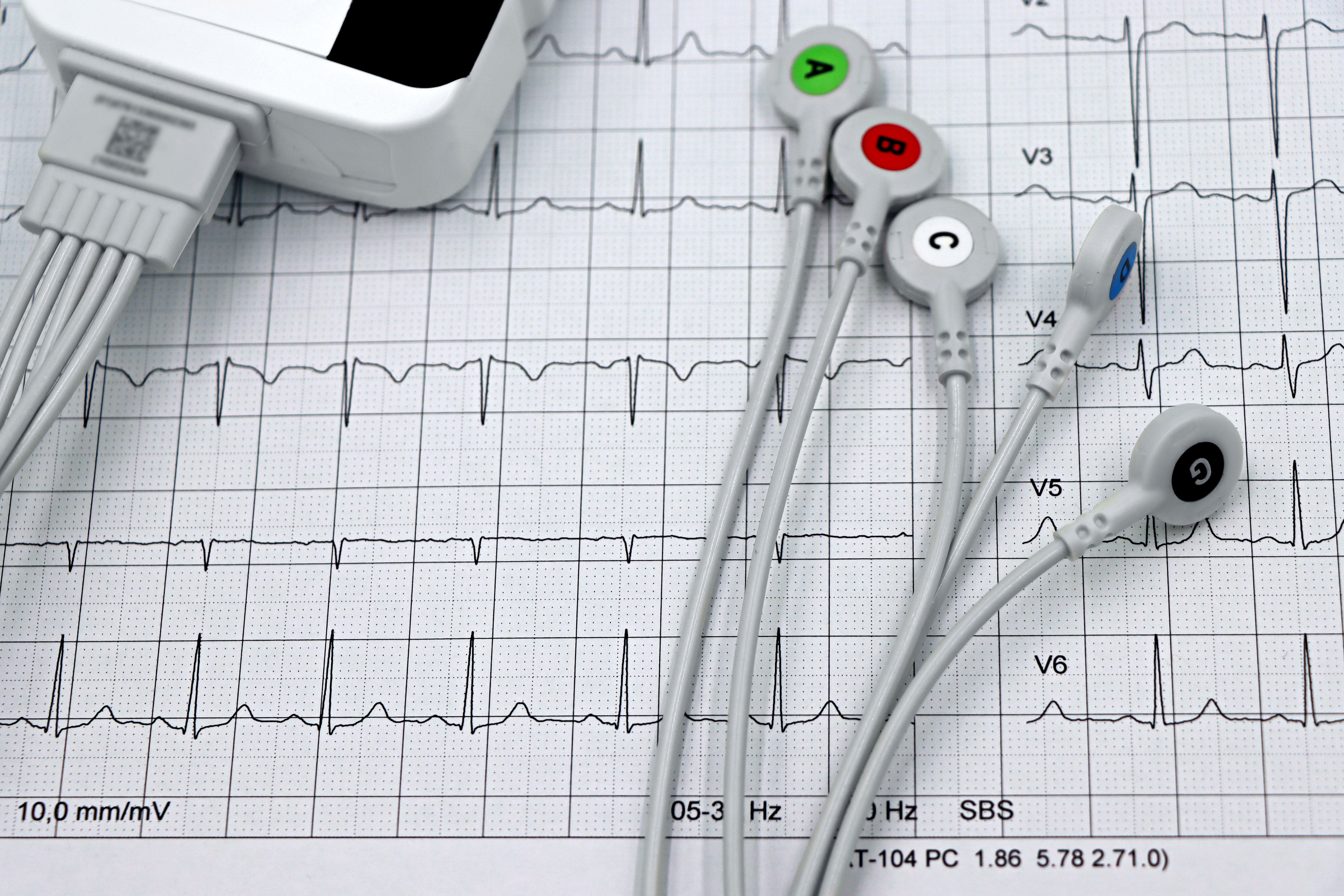 Elastic AI-Powered Skin Patch Analyzes Heart Activity in Real Time